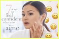 How To Feel Confident With Acne?