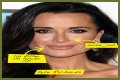 Botox, Implants & More! – Hollywood Life