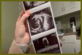 Counting On Alum Joy-Anna Forsyth Updates At 33 Weeks Pregnant